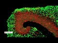 How to Grow Cerebral Organoids from Human Pluripotent Stem Cells