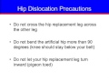 Total Hip Replacement: Pre- and Post-op Preparation