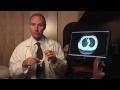 Lung Cancer Surgery