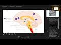 Emerging Therapies for Cluster Headache by Zarmina Mufti, MD