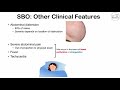 Small Bowel Obstruction (SBO) | Risk Factors, Causes, Signs & Symptoms, Diagnosis, Treatment