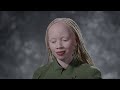 Thando Hopa breaks stereotypes, as she becomes global icon— #MyHistoryMoment S02