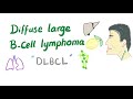Diffuse Large B-Cell Lymphoma (DLBCL) - Aggressive  B-Cell Neoplasm - Non-Hodgkin’s Lymphoma