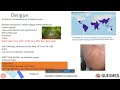 MRCP: Infectious Diseases Questions, Tips and Tricks for MRCP Part 1 and MRCP Part 2