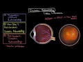 Diabetic retinopathy | Endocrine system diseases | NCLEX-RN | Khan Academy