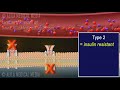 Diabetes Type 1 and Type 2, Animation.