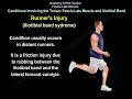 Anatomy Of The Tensor Fascia Lata Muscle - Everything You Need To Know - Dr. Nabil Ebraheim
