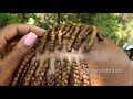 NEW TECHNIQUE| ALOPECIA + HAIR LOSS| BOX BRAIDS | @IRENESBRAIDS