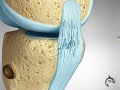 ACL (Anterior Cruciate Ligament) MCL (Medial Collateral Ligament) Tear and Repair - 3D Animation
