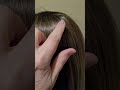 Lightweight Hair Topper for Hairloss New Inventory Hairloss Alopecia