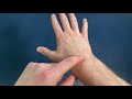 How to Fix Wrist Pain for Good