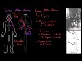 Upper motor neurons | Organ Systems | MCAT | Khan Academy