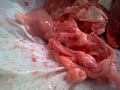 bamdev shiv sir heart dissection