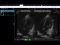 NVIS Orthanc DICOM Demo 2