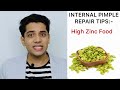 Face Pimples Treatment At Home | ACNE TREATMENT | Pimples Kese Hataye |  #shivammalik