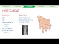 Rheumatoid Arthritis in 3 Minutes