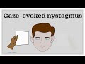 HINTS exam (Head Impulse, Nystagmus, Test of Skew)