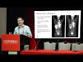 Novel Immunotherapies (CAR T, Bispecifics, and ADCs) - Jeremy Abramson, MD