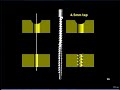 Principles of Orthopaedic Screws | Orthopaedic Academy