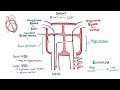 Ventricular septal defect (VSD) - repair, causes, symptoms & pathology