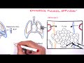 Pleural Effusion (DETAILED) - (pathophysiology, signs and symptoms, treatment)