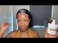 HOW I GOT RID OF MY BODY DISCOLOURATION | A Quick and Easy Guide for an even skin tone ‼️