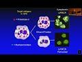 Current issues in ANCA associated vasculitis