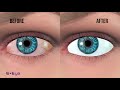 How does E-Eye work