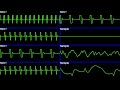 dek [Konami SCC+ & 3xGeneric PCM DAC]