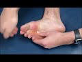 How to CRACK Your Toes and Feet