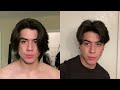 Hair Growth Time Lapse - 7 Months