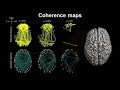 Resting-state EEG (RSEEG) Explained! | Neuroscience Methods 101