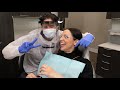 Dental Cleaning | Dentist Cleans Her Dental Hygienist's Teeth