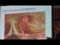 Cardioembolic Stroke 心源性中風 (4)