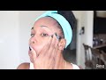 How to Brighten Skin, Reduce Acne Scars, Hyperpigmentation & Discoloration | Home Remedies