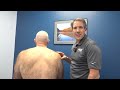 Winging Scapula - Long Thoracic Nerve Palsy Exam