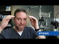 Top 3 Causes Of DOUBLE VISION (What Is Diplopia?)