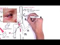 Polyarteritis Nodosa and Kawasaki Disease (Medium Vessel Vasculitis) - Symptoms, pathophysiology