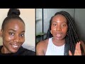 How to Get Rid of Dark Spots/Hyperpigmentation FAST (6 Weeks) | MRS ZINYAMA