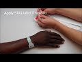 How to Apply the ComfortBand™ Plus wristband