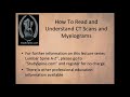 How to Read the CT Scans | How to Read CT Myelograms | How to Read Spine Imaging