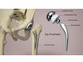 Orthopedics Instruments Video No 19