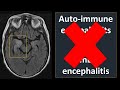 Imaging of Auto-immune Encephalitis