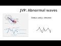 Abnormal JVP waves - Quick Overview