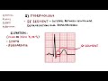 ECG Interpretation Made Easy (Learn How to Interpret an ECG in 13 Minutes)