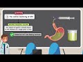 How to Prevent a Feeding Tube Clog