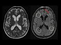How to read an MRI of the brain?