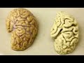 Unlocking Alzheimer's Microglia's Key Role in Brain Health Revealed