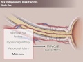 Ischemic Optic Neuropathies